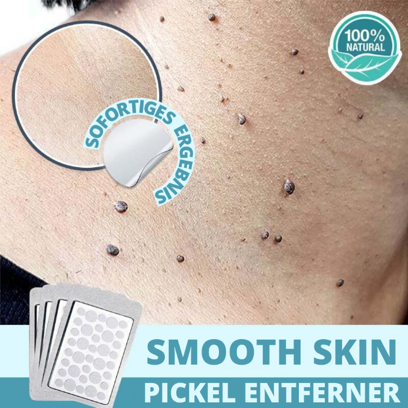 Smooth Skin - Pickel Entferner